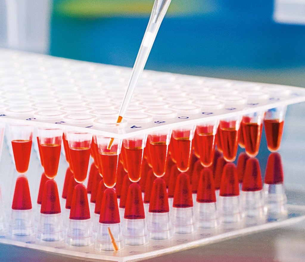 Top 10 PCR Microplate Manufacturers in China Top 10 PCR Microplate Manufacturers in China